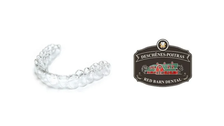 Guard Your Game With Red Barn Dental